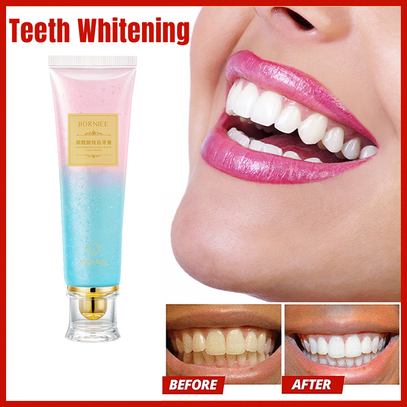 Teeth Whitening Toothpaste 100g Niacinamide Fresh Remove Plaque Stains ...