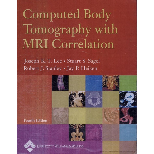 Computed Body Tomography with MRI Correlation | Shopee Philippines
