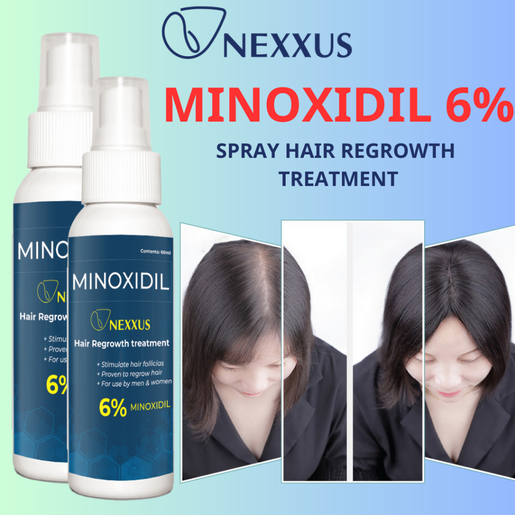 NEXXUS Minoxidil Spray Hair Regrowth Treatment Topical Solution for ...