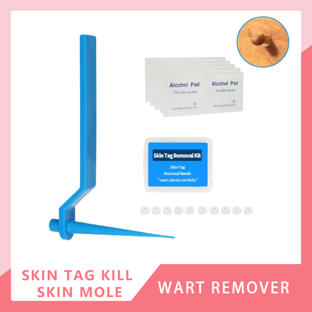 Skin Tag Remover Band Warts Removal Rubber Band Adult Mole Kulugo Remover Kit With Cleansing