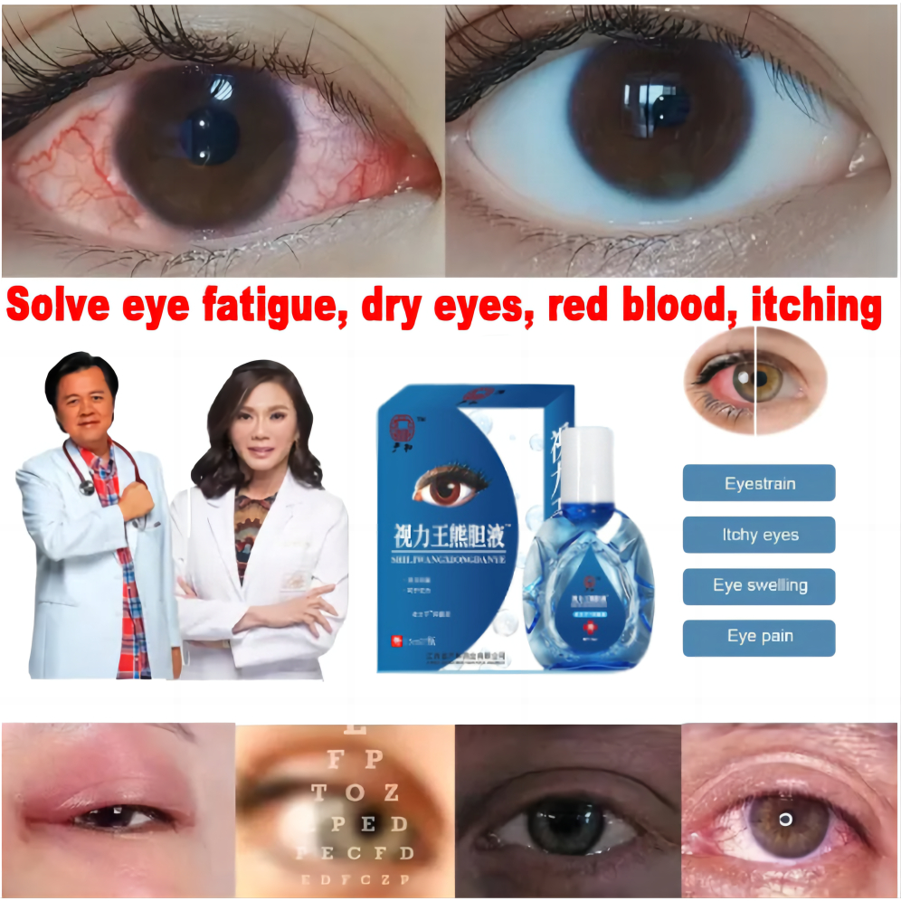 Eye Drops for Clear Vision Dry Eyes Congestion Eyes Blurry Eyes Red Eye
