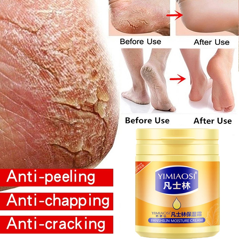 Vaseline Foot Cream Heel Anti Crack Lasting Moisturizing Hand Foot