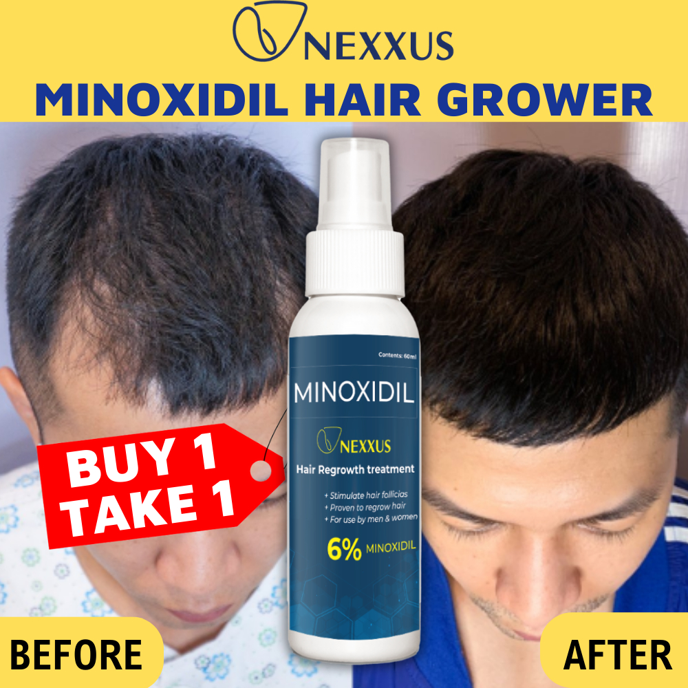 Minoxidil 6% Hair Growth Serum Fast Hair Growth Hair Loss Treatment ...