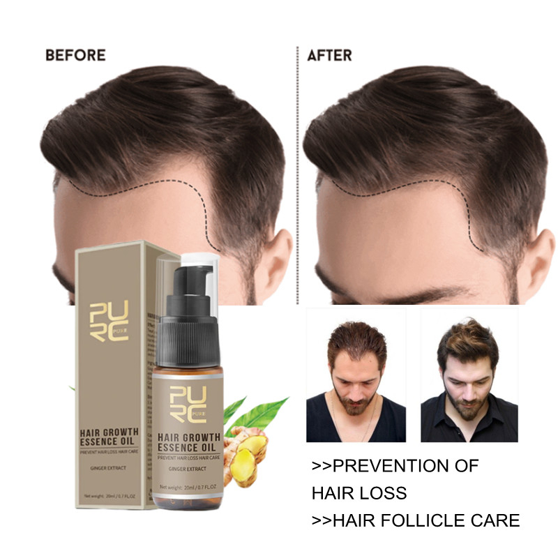 Authentic Purc Hair Growth Serum Fast Hair Growth Spray And Scalp Treatment Pampatubo Ng Buhok 3723