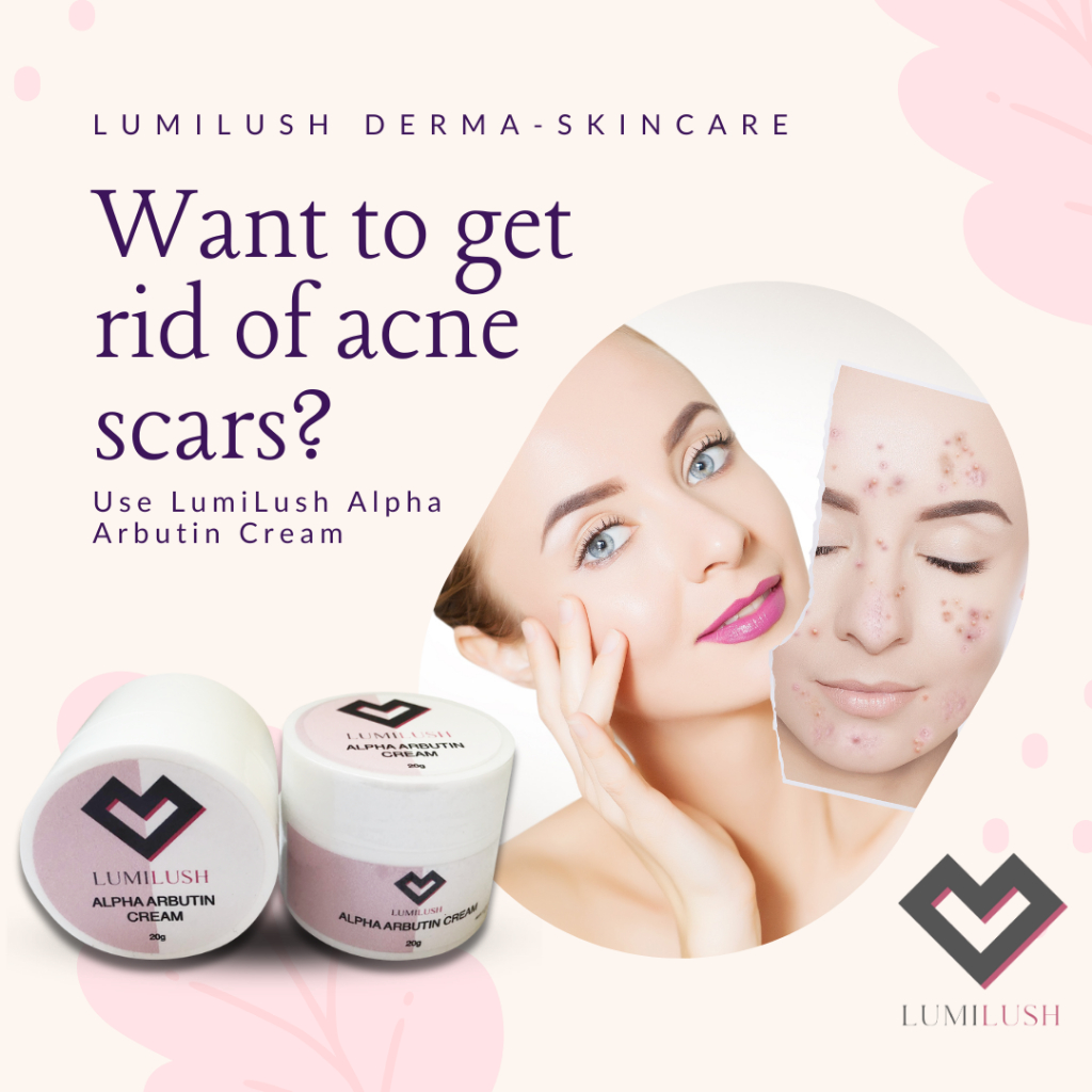 Lumi Lush Alpha Arbutin Cream 20g by Lumi Lush Brighten Lighten Acne