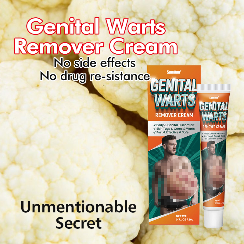 60g Genital Warts Remover Cream Original Mole Remover Skin Tag Removal Warts Removal Shopee 1492