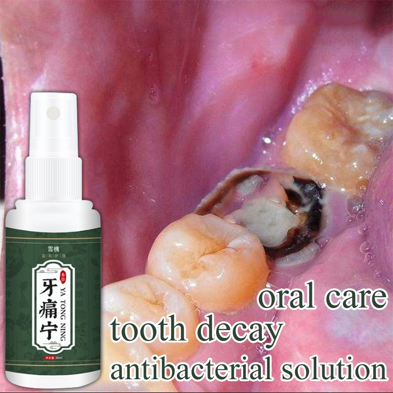 toothache pain relief spray tooth pain toothache reliever 30ml solve