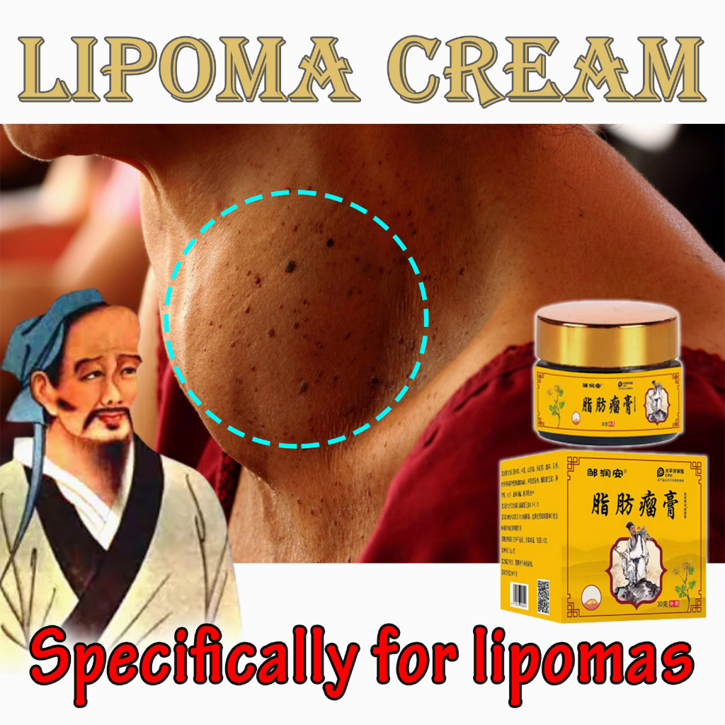 lipoma removal ointment original japan lipoma cream bukol remover gamot ...