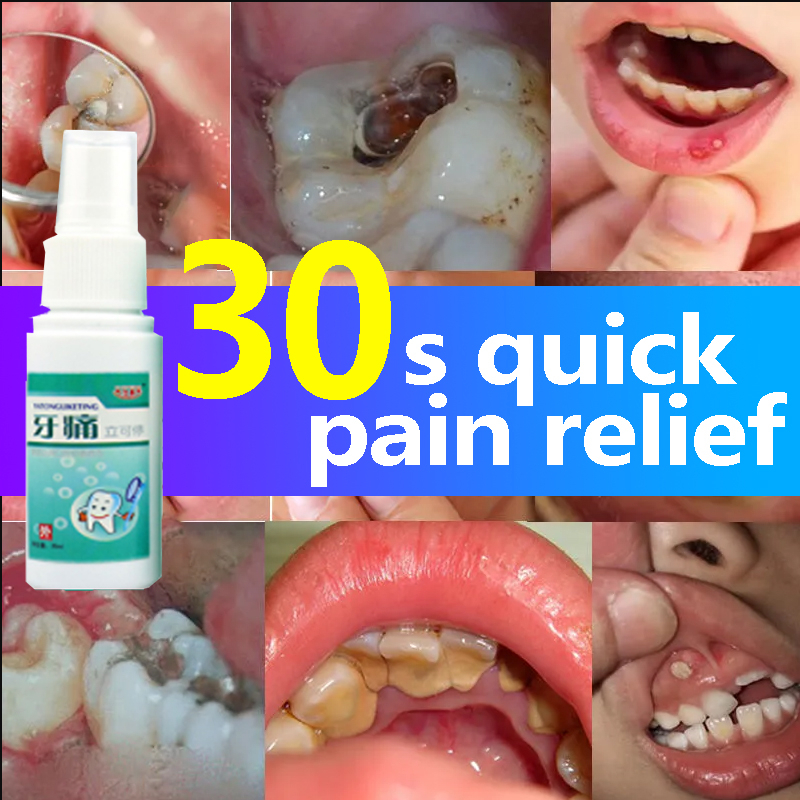 Toothache Insect Repellent Spray Toothache Pain Relief Oral Spray Tooth