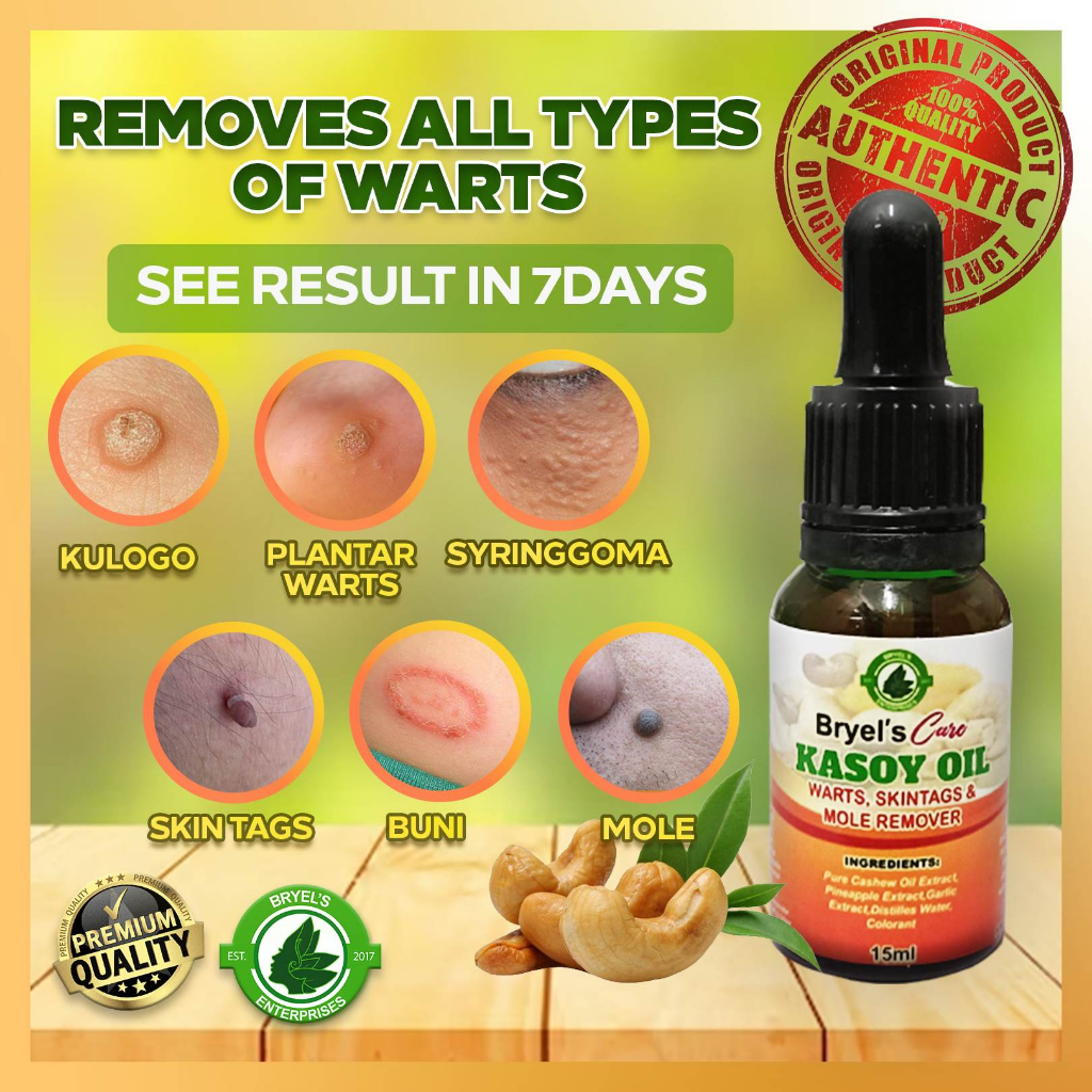 Bryels Care Original Wart And Mole Remover 10ml Skin Tag Removal Kasoy Oil Warts Remover 