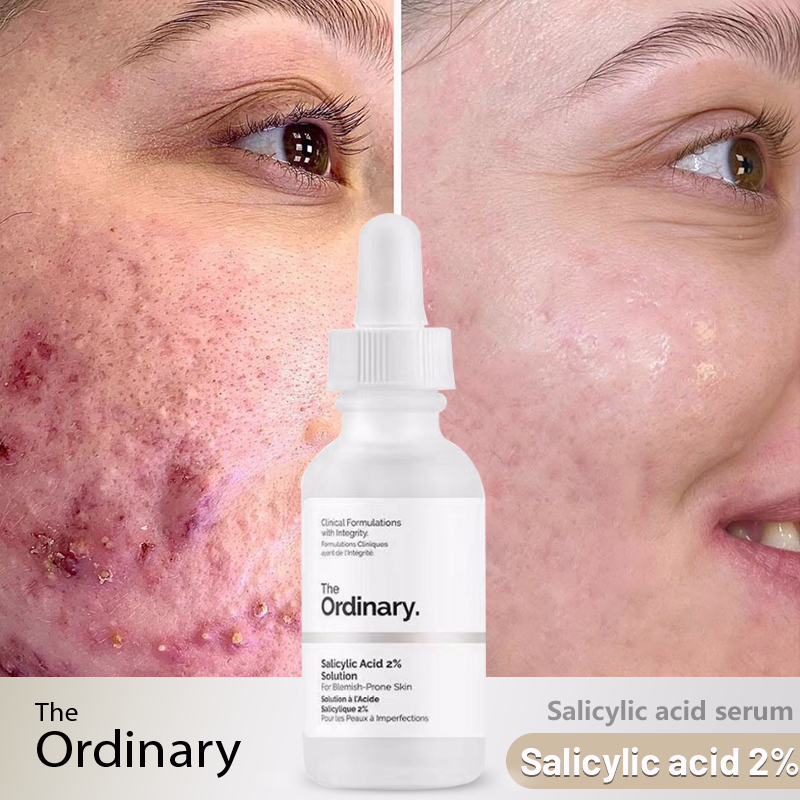salicylic acid serum facial the ordinary salicylic acid repair skin