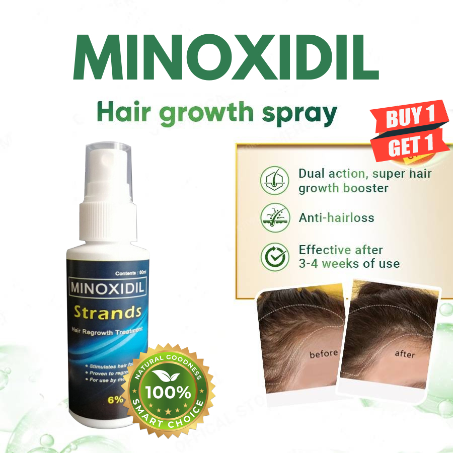 Minoxidil Nexxus 6% Minoxidil Topical Solution Hair Grower beard Grower ...