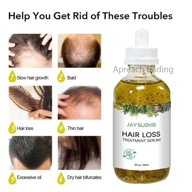 Jaysuing Hair Loss Treatment Serum Fast and Easy Hair Growth Baldness