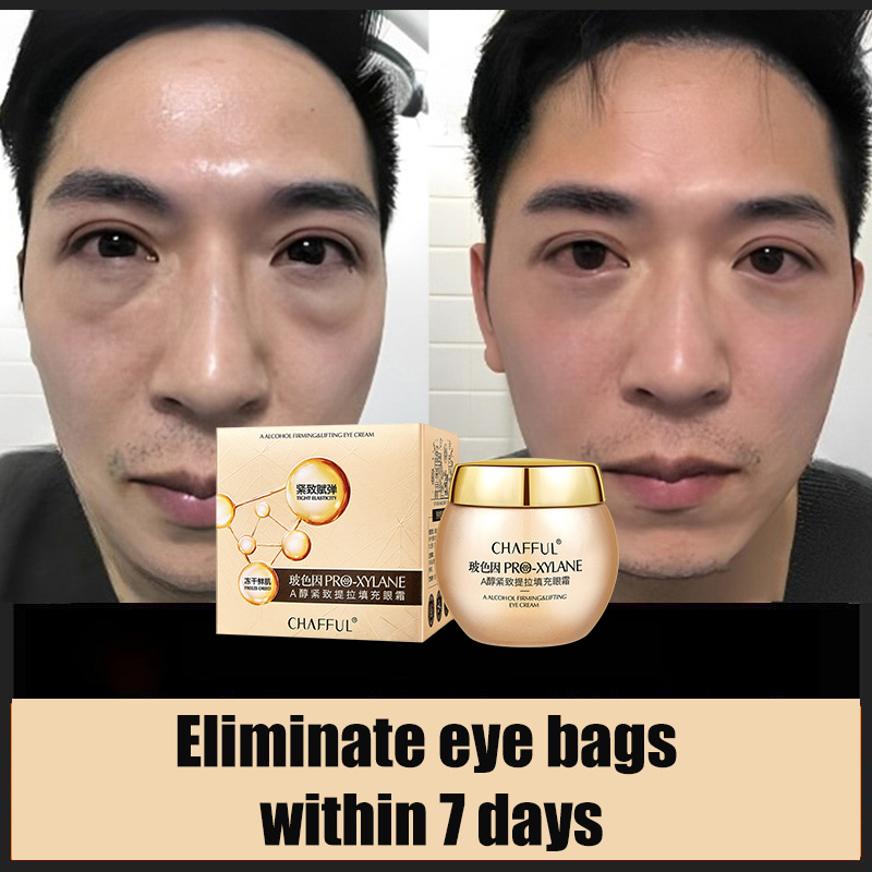 Retinol anti aging Eye Cream Removing eye wrinkles Eyebag Dark Circle