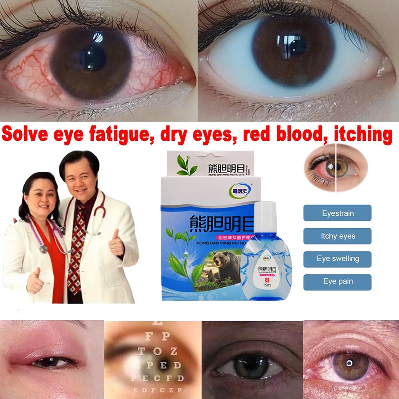 Bear Bile Eye Drops Dry Itchy Eyes red blood Eye fatigue Drops Sore