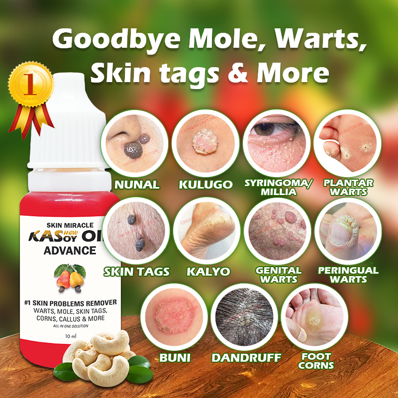 No.1 Skin Problems Remover: Mole, Warts, Skin Tag (Effective ...