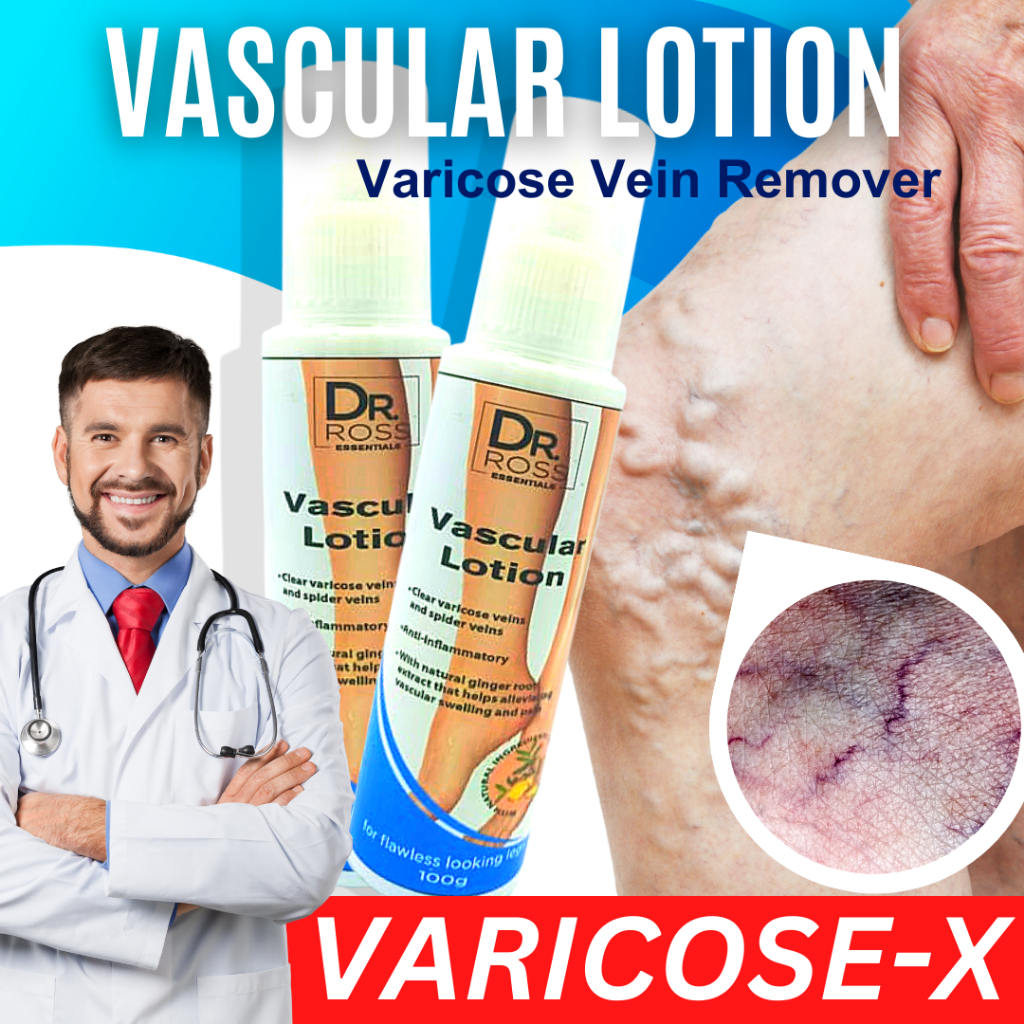 VASCULAR LOTION for varicose vein and spider vein Remover Glee Skin