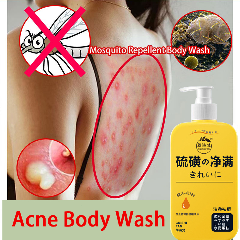 sulfur shower gel whitening soap/removes mites removes acne and