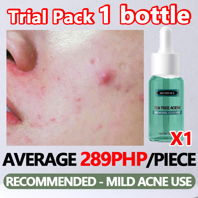 HEMEIEL Acne Treatment Serum, Adapalene, Pimple Remover, Anti Acne, Oil