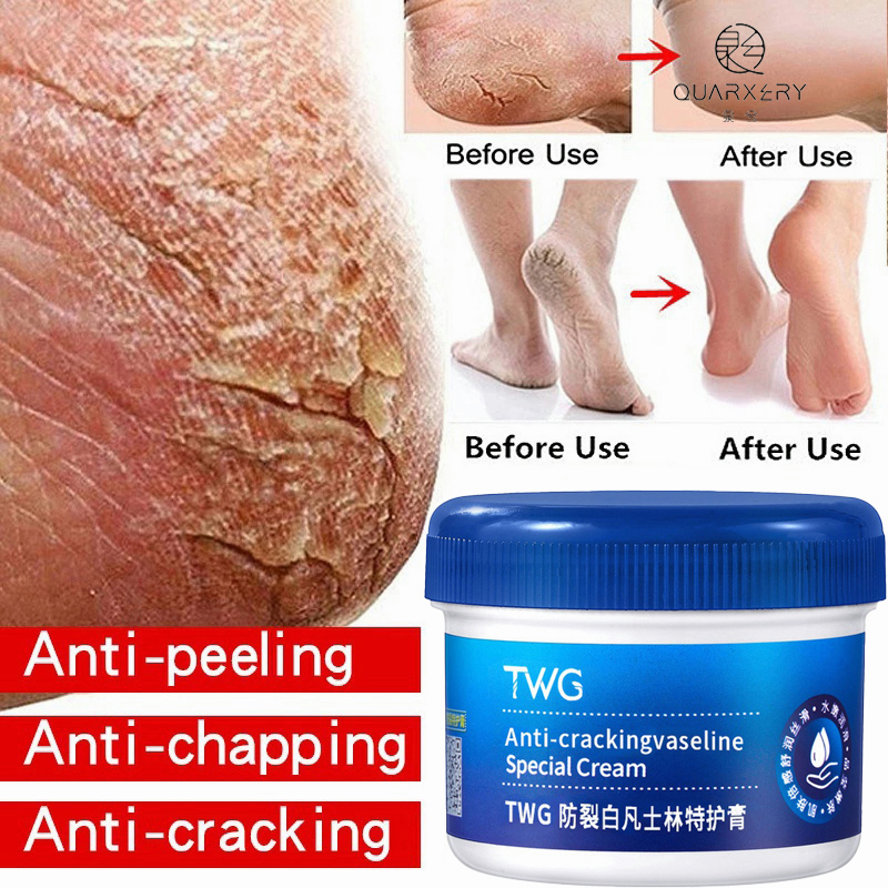 Vaseline Foot Cream For Cracks And Dry Hand Cream Moisturizer Whitening