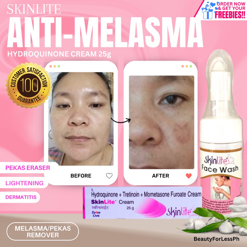 SkinLite Facial Foam Wash and Cream COMBO Melasma Cream whitening cream