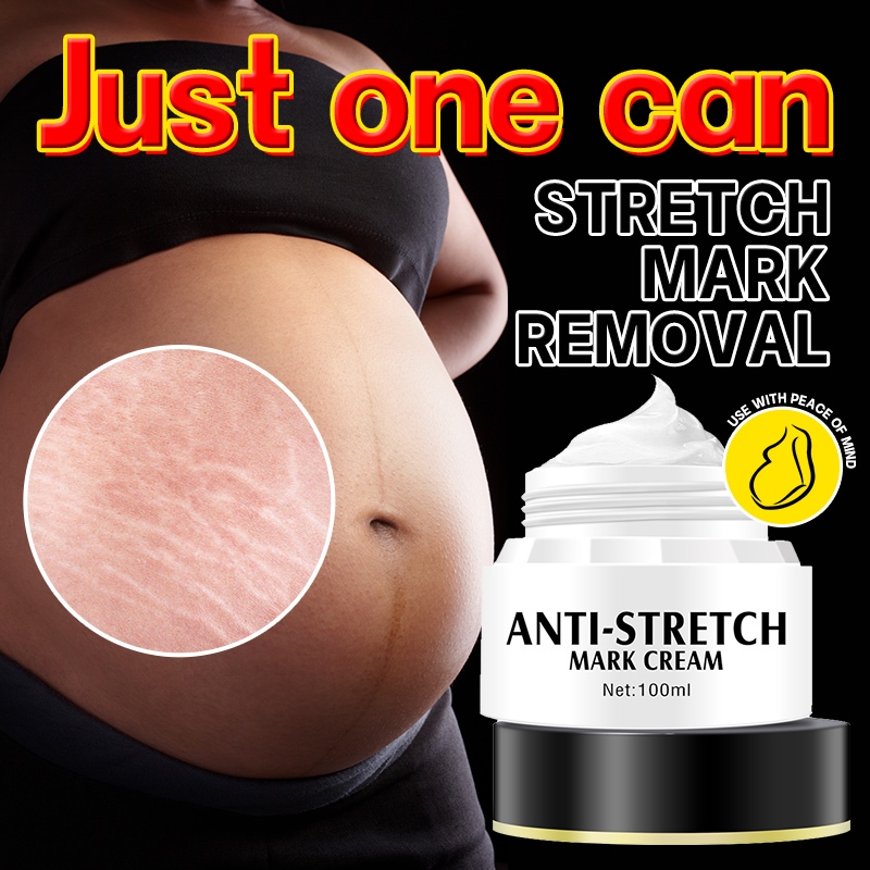 Original Anti-Stretch Mark Cellulite Remover Anti Scar Cream Firming ...