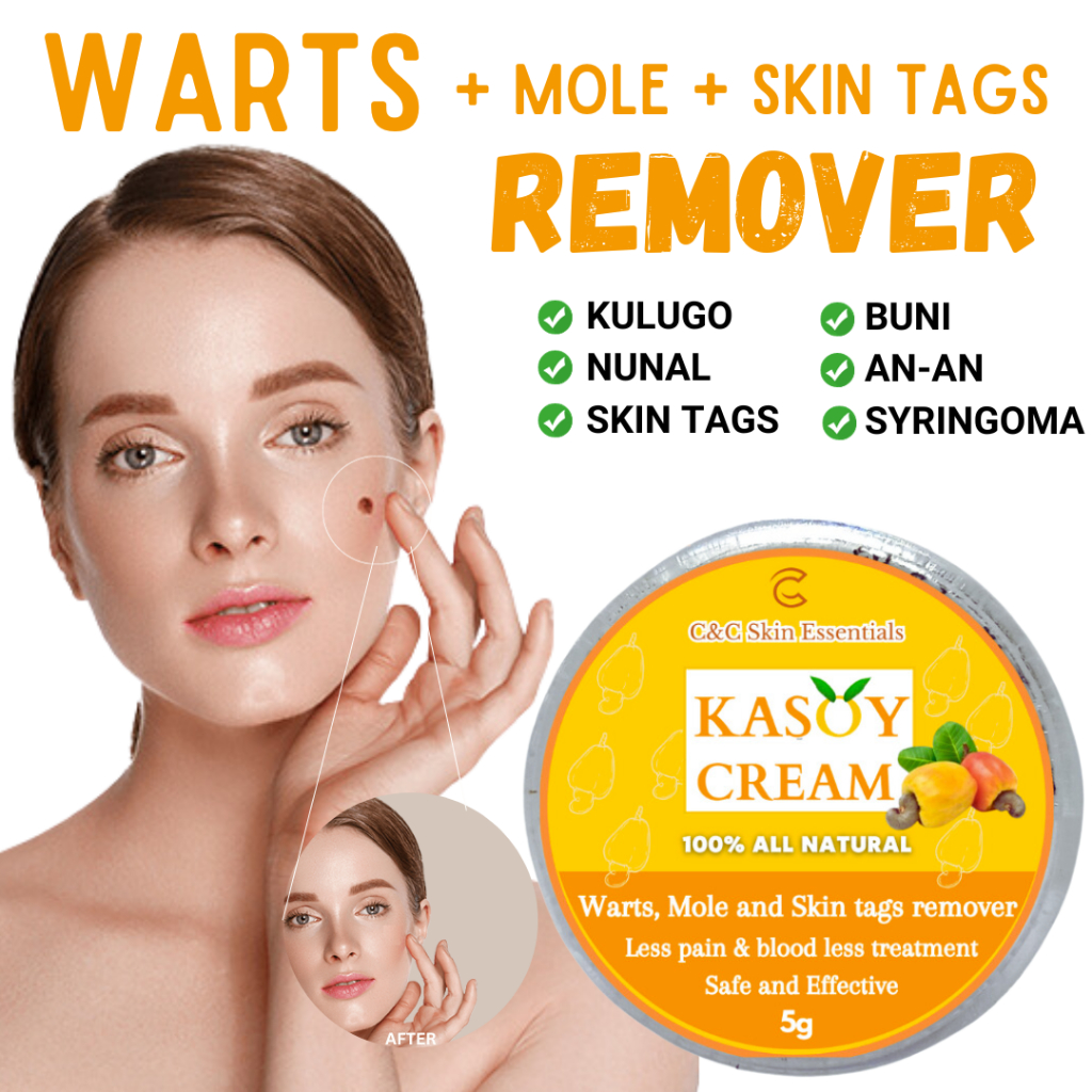 Organic Kasoy Cream: The Original Organic Formula for Safe and ...