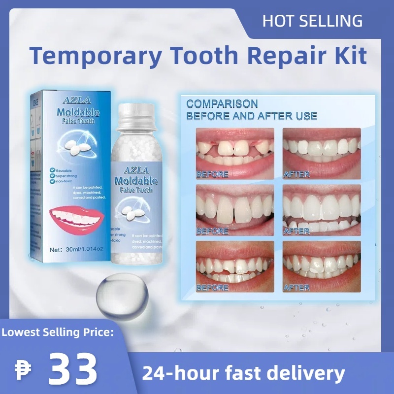 AZLA 30ML Temporary Tooth Repair Kit Teeth and Gaps Moldable False ...