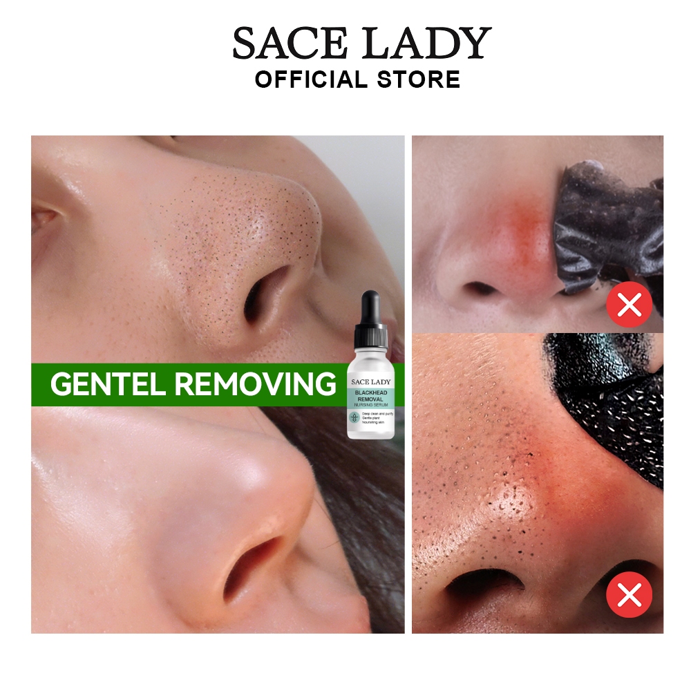 SACE LADY Blackhead Removal Nursing Serum Deep Clean Purify Gentle ...