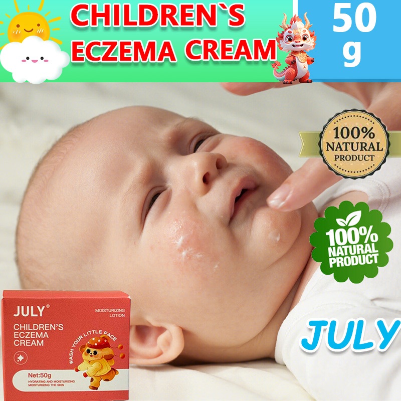 JULY Baby eczema cream Eczema cream itch relief antifungal for various skin diseases 50g