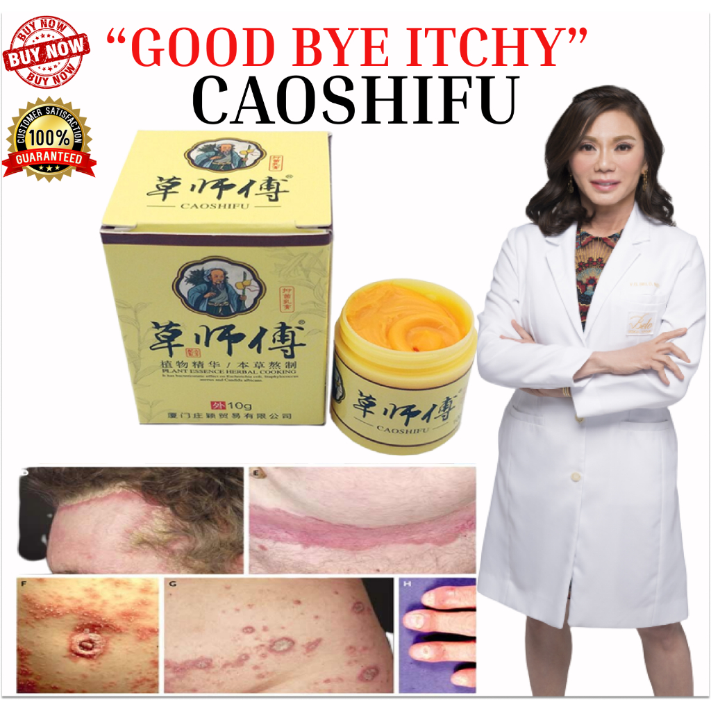 Caoshifu 50g Eczema Treatment Ointment Antibacterial Psoriasis Cream Herbal Itching Skin Care 0267