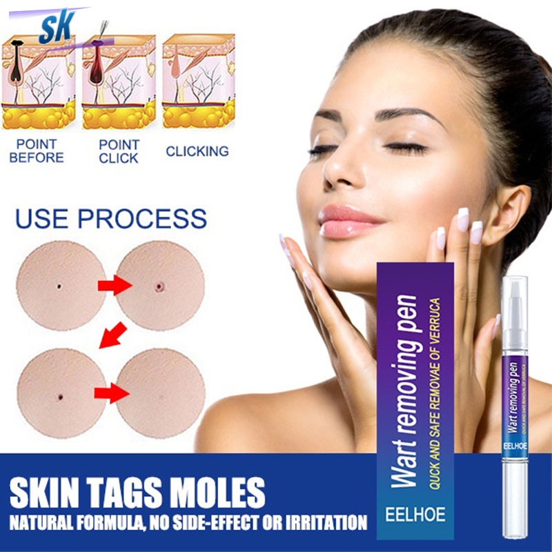 eelhoe Wart and Mole Remover Facial Skin Tag Removal Pen Foot Corn