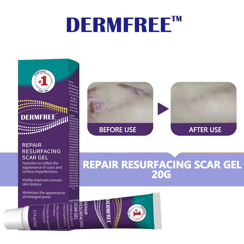 DERMFREE Scar Remover Cream 20G Peklat&Keloid Scarminator Cream Treat