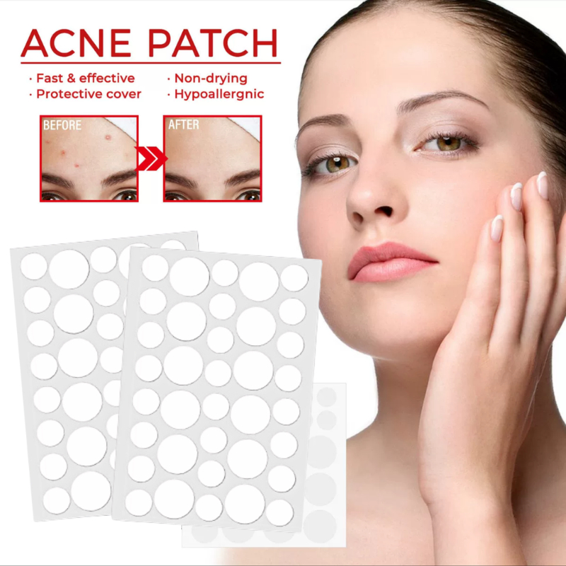 36PCS/Sheet Acne Pimple Patch Salicylic Acid Acne Treatment Stickers ...