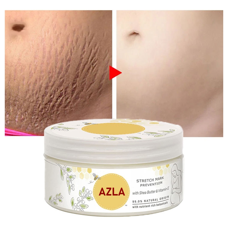 AZLA Stretch Mark Repair Cream Removes Old Scars Growth Lines Cream ...