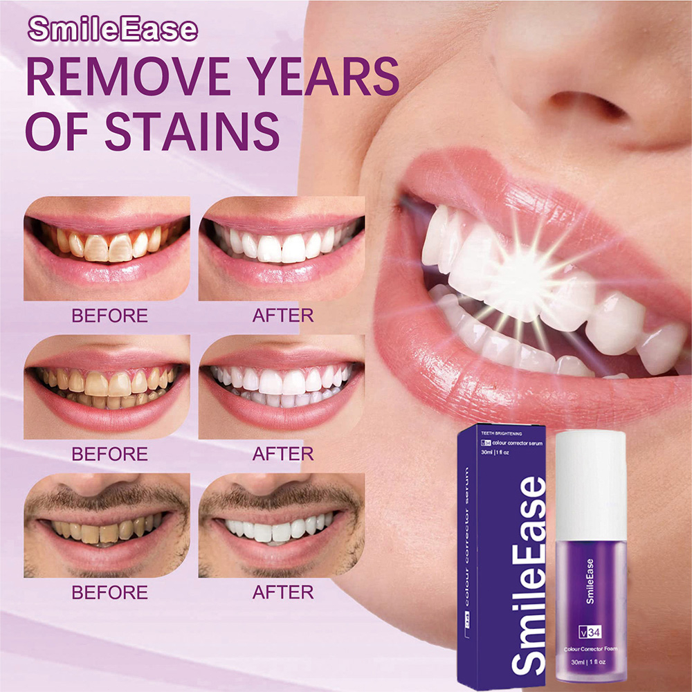 smile-ease-toothpaste-v34-colour-correct-whitening-teeth-tartar-plaque