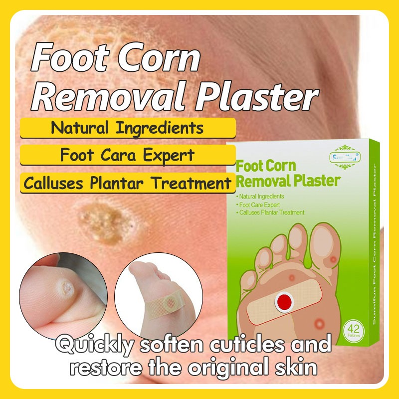 Foot Corn Remover Patch 42PCS Gamot Sa Kulugo Corn Removal Plaster Skin ...