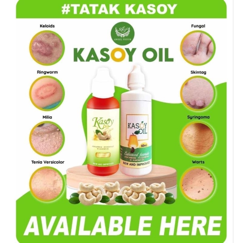 Kasoy Oil 60 ml Original | Shopee Philippines