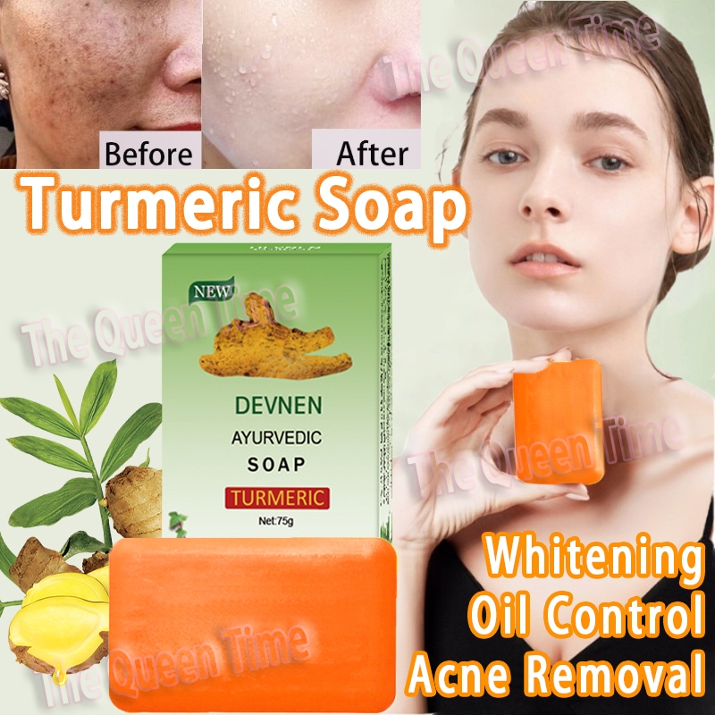 10 Pack Shanghai Sulfur Soap – Acne, Blackhead, Anti-Mites, Oily Skin (85g Each)