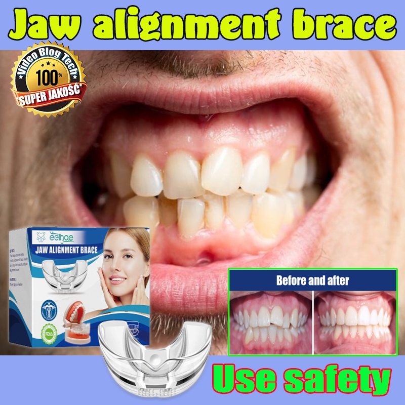 Dental Orthodontic Appliance Teeth Alignment Teeth Aligner Trainer