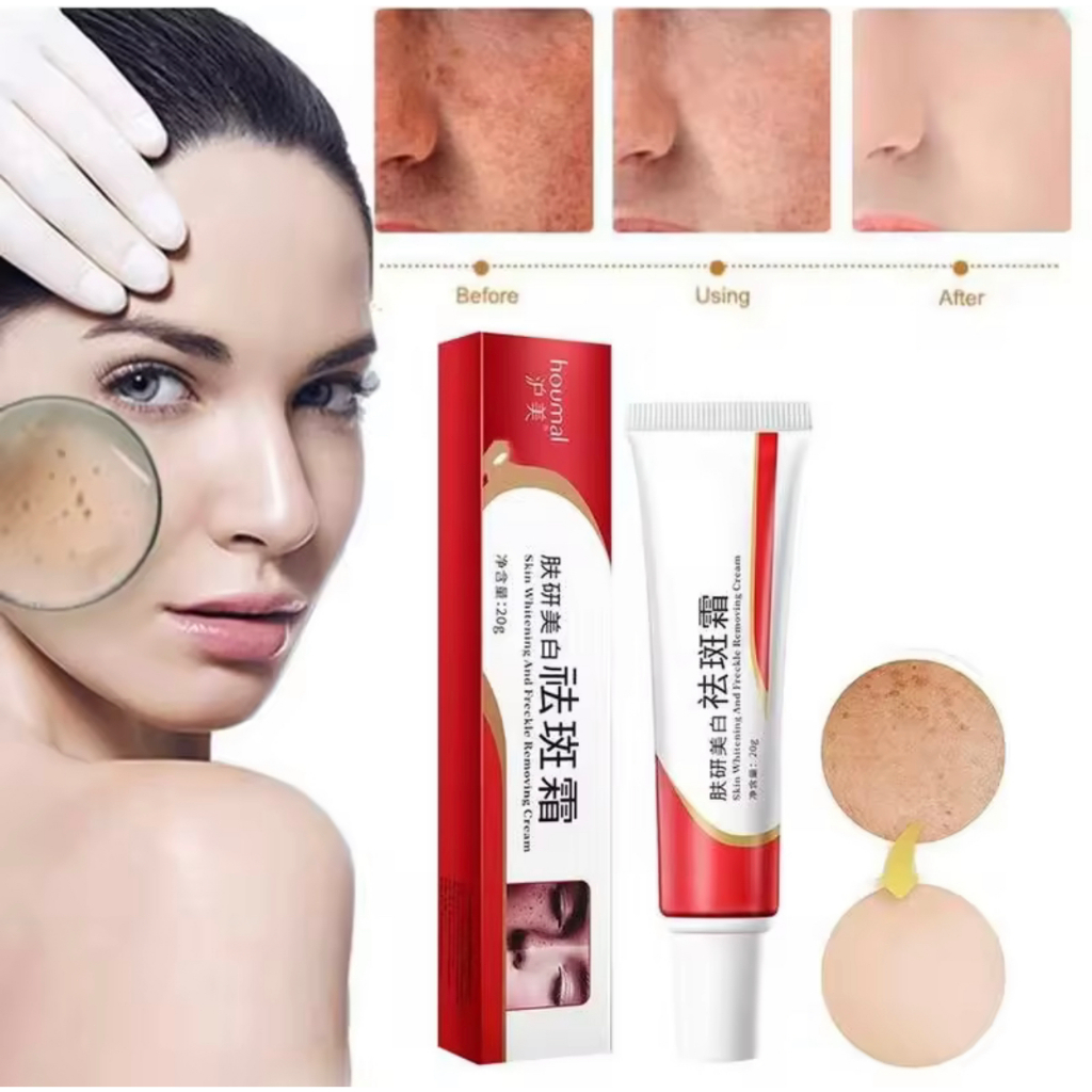 Melasma Cream Pekas Remover Original Collagen Pekas Freckles Remover
