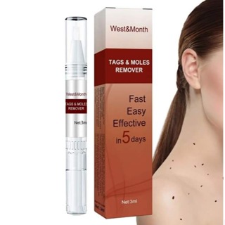 Mole Remover For Face Body, Tags Moles Remover Pen Fast Easy Effective In 5  Days Easy To Remove Tags, Moles, Warts