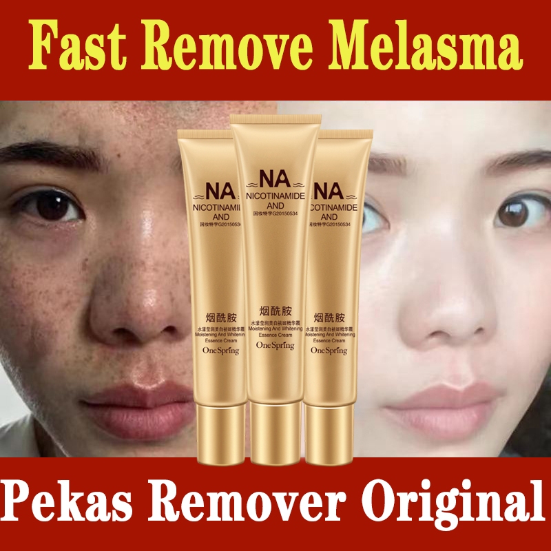 YANJIAYI Nicotinamide Whitening Freckle Melasma Cream For Face Anti Dark Spot Pekas Remover G