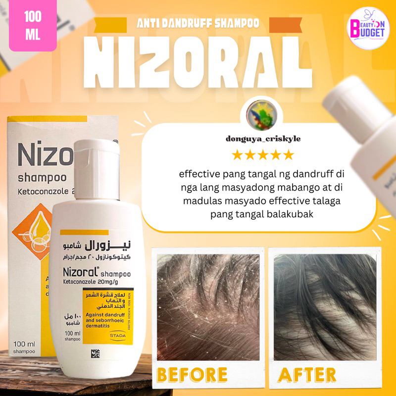 EXP DATE 11/2024 Nizoral Shampoo Ketoconazole 20mg 100 ML Shopee