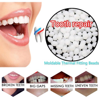 Temporary Tooth Filling Repair Kit Thermal Beads Solid Glue for Teeth  Veneer