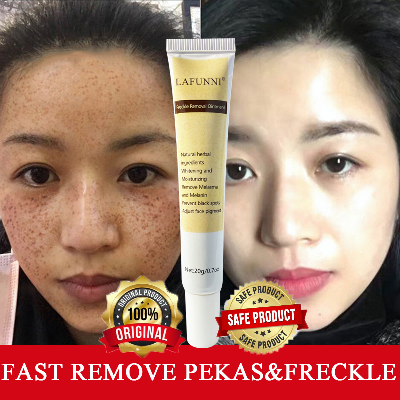 Lafunni Effective Melasma Cream Pekas Remover Skin Whitening Moisturizer Anti Freckle Cream 20g