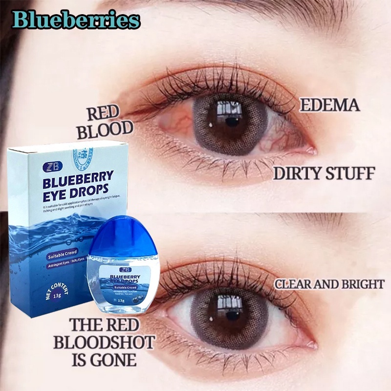 Blueberry Eye Drops Itchy Eyes Eye Drops Dry Eyes Eye Drops