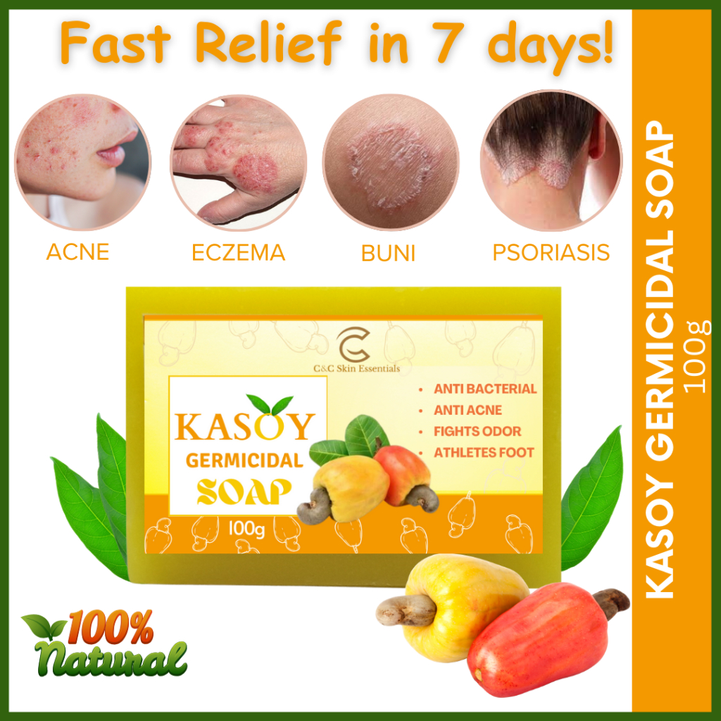 Kasoy Soap Original Your Natural Remedy for Itchy Skin, Buni, Allergy