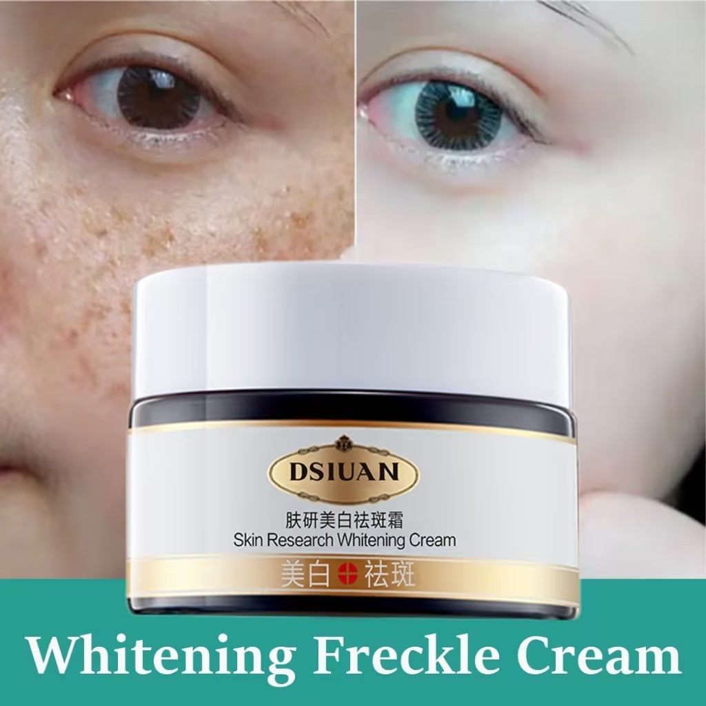 Pekas Remover Melasma Cream Whitening Freckle Cream Brighten Face Dark