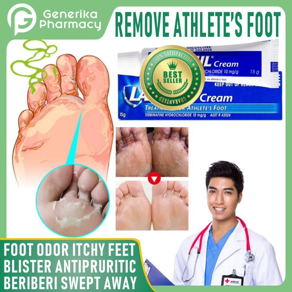 Antifungal Cream Athlete's Foot Cream for Beriberi ltching Tinea